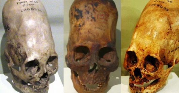 Những chiếc hộp sọ biến dạng được phát hiện tại nhiều nơi trên thế giới.