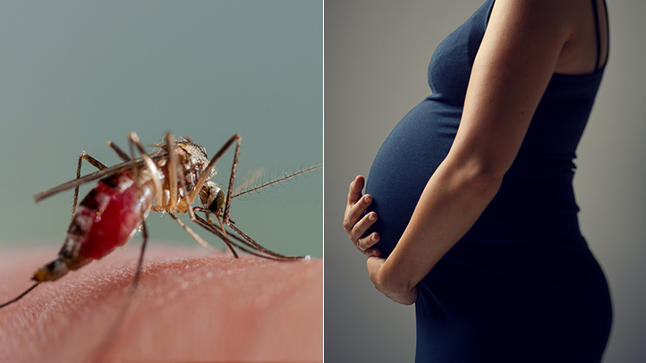 Birth-Defects-Linked-to-Zika-Include-More-Than-Microcephaly-RM-722x406
