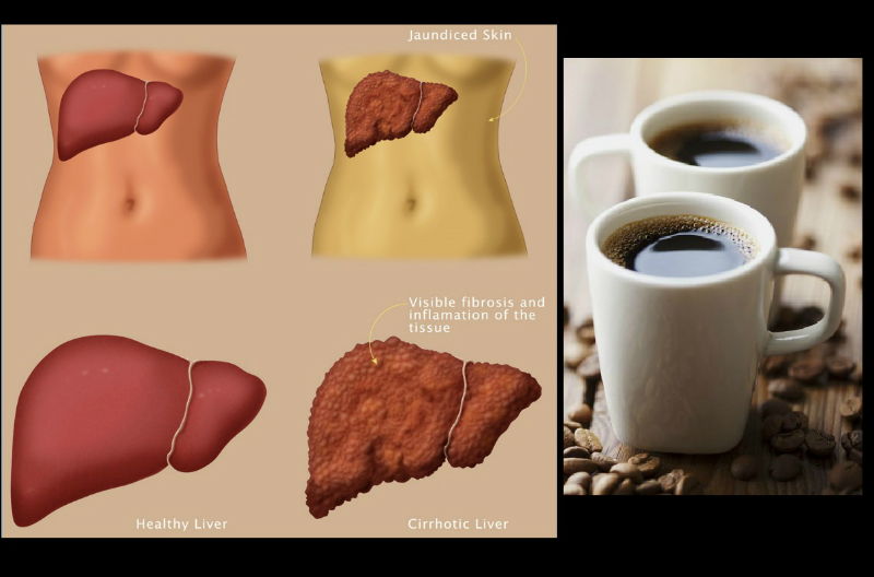 Cure-Liver-Damage-by-Alcohol-with-Cofee