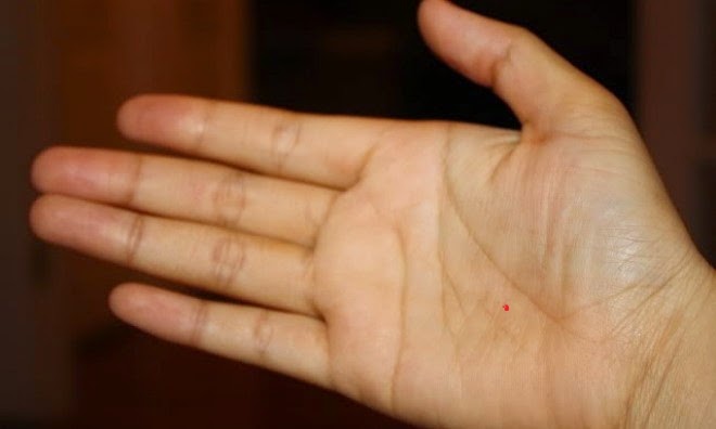 Nốt ruồi ở lòng bàn tay tượng trưng