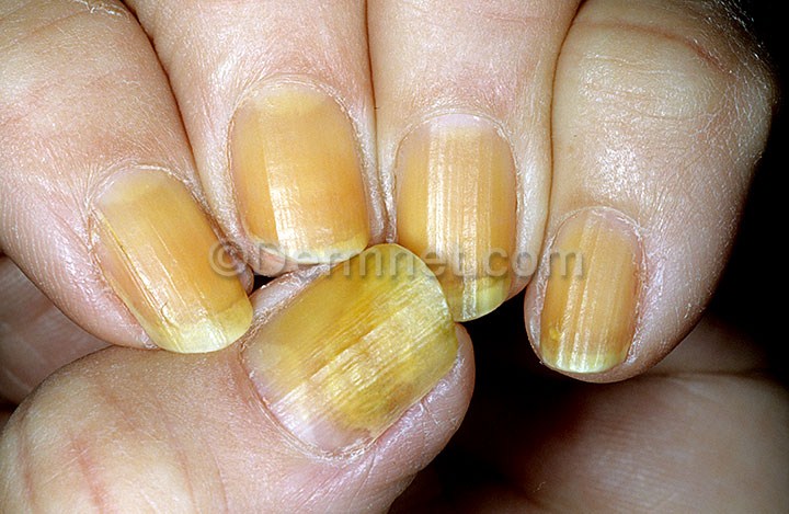 yellow-nails-12