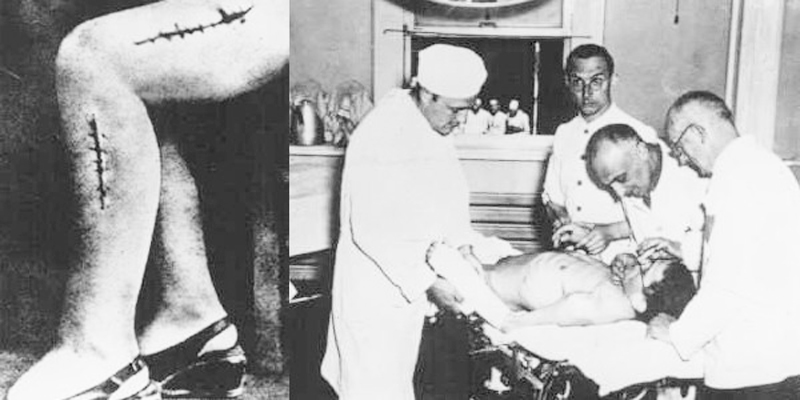 Những vết khâu chằng chịt trên cơ thể nạn nhân của thí nghiệm do bác sĩ của Đức Quốc xã thực hiện. (Ảnh: National Archives)