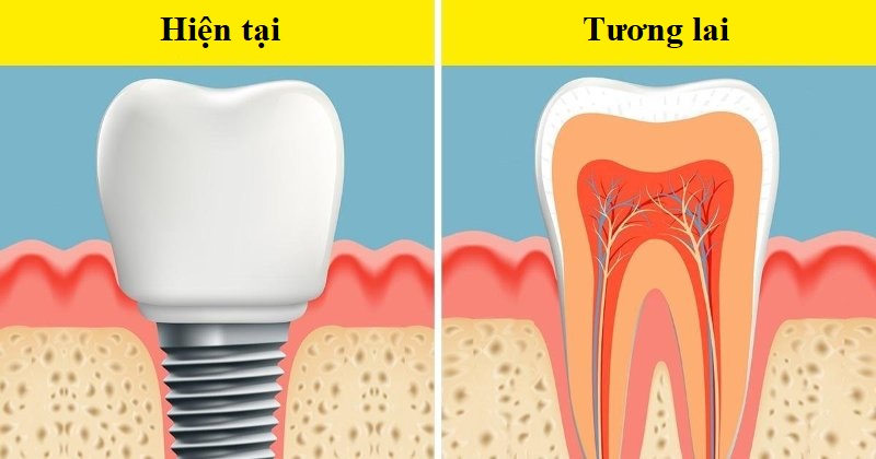 Trong trương lai không xa, mọi người có thể không cần đi chồng răng giả nữa. (Ảnh qua LinkedIn)