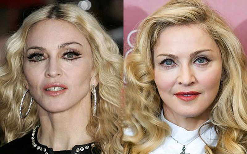 Gương mặt Madonna cứng đơ không khác gì tượng sáp