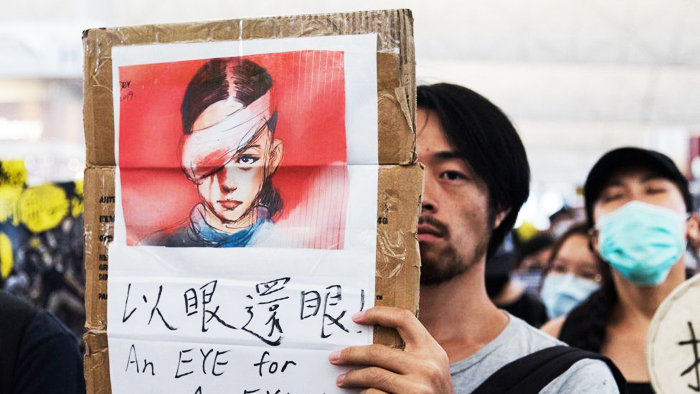 Người biểu tình Hồng Kông đeo băng gạc thẫm đỏ để tỏ sự đồng lòng với một người biểu tình bị bắn vào mắt trước đó.