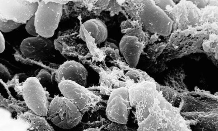 Vi khuẩn Yersinia pestis gây ra dịch hạch. 