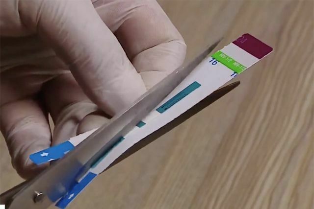 Nhân viên y tế của Bệnh viện Xanh Pôn cắt đôi que thử HIV. 