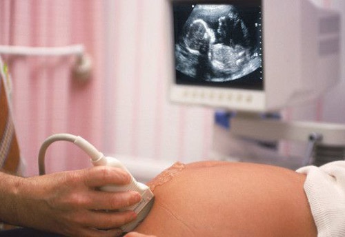 Người nhà cho biết quá trình theo dõi tại bệnh viện, thai nhi vẫn bình thường nhưng sau vài giờ, tim thai ngừng đập. 