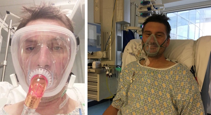 Adam Martin, 41 tuổi, người Anh đã suýt mất mạng chỉ vì xỉa răng sai cách khiến nhiễm trùng tim.