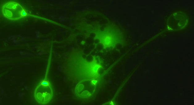 Đây là hình ảnh về bào tử của Henneguya salminicola, một loài ký sinh trùng không dùng oxy để hô hấp.