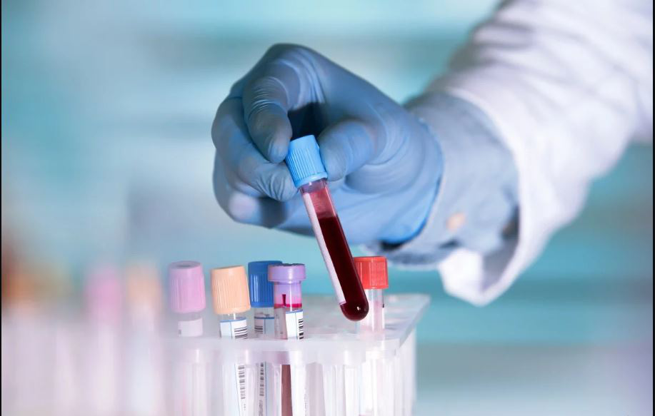 Một nghiên cứu sơ bộ cho thấy nhóm máu A dễ nhiễm virus Vũ Hán chủng mới hơn và nhóm máu O khó bị nhiễm hơn. (Ảnh qua SCMP)