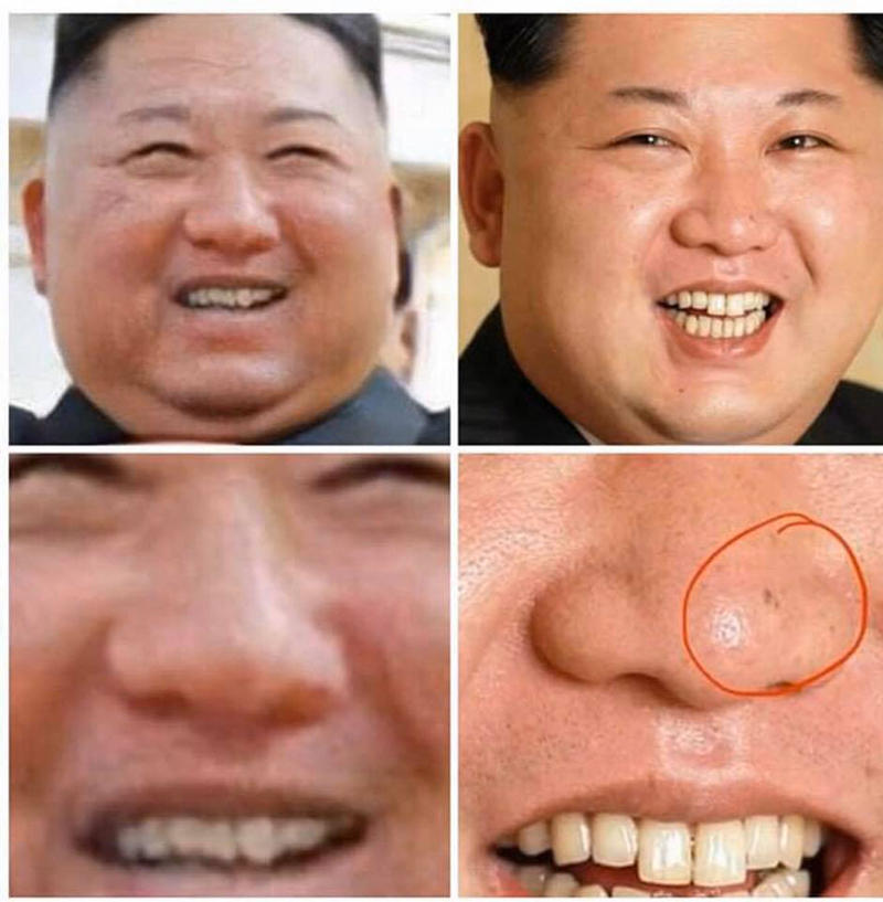 nốt ruồi trên mũi Kim Jong-un cùng vẻ ngoài và nụ cười so với người hiện tại đều không giống nhau