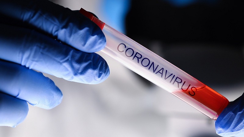 Trước hàng loạt bằng chứng, FDA và CDC thừa nhận các xét nghiệm Covid-19 “có sai sót”